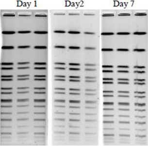 EtBr stain