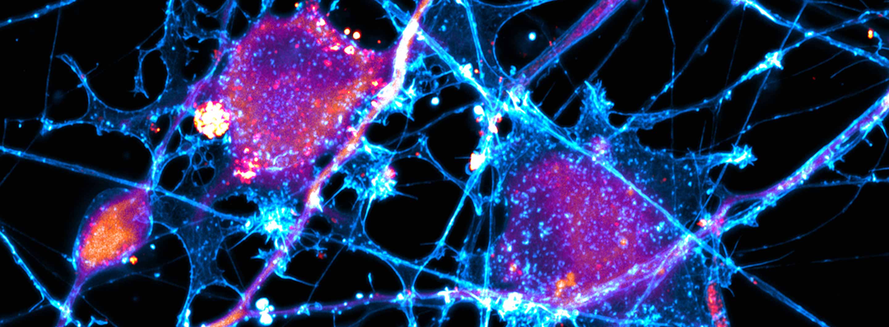 Action neurons imaged by the Uri Manor lab