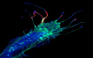 Colored microscopic image of red and fuschsia calcium bursts in filopodia from a frog spinal nerve cell