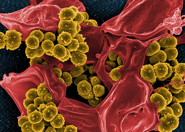 Methicillin-resistant Staphylococcus aureus