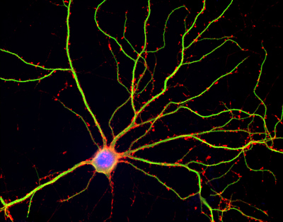 Hippocampal neuron in culture