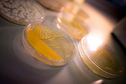 Yellow Geotrichum candidum on a petri plate