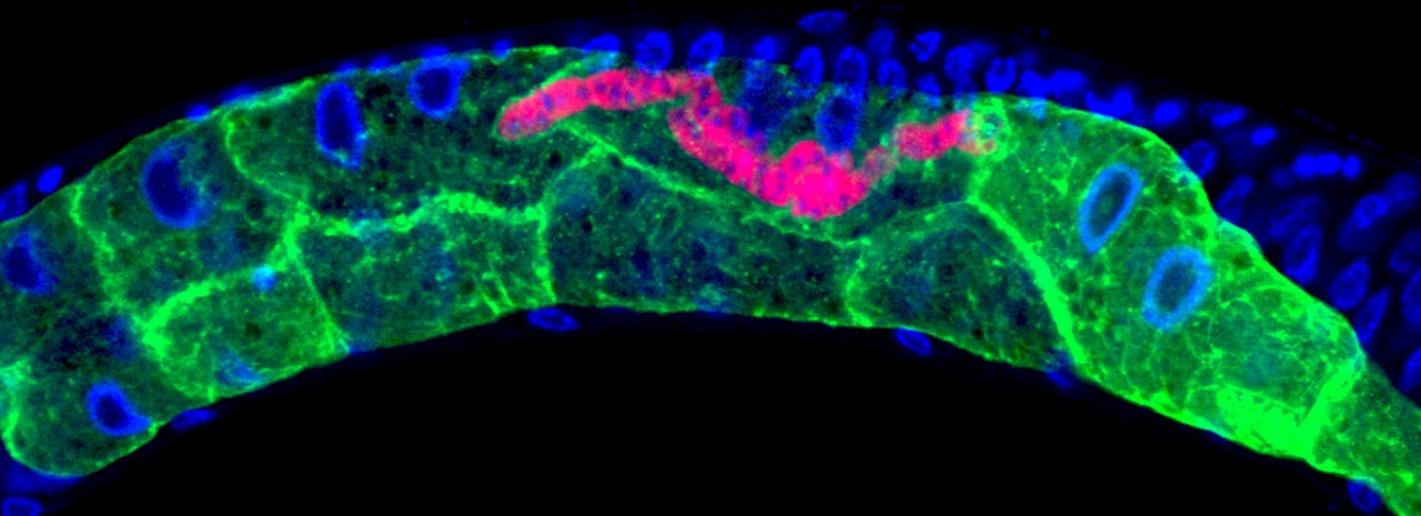 Microsporidia