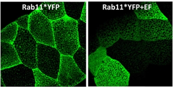 Microscope shot of Drosophila salivary glands expressing an activated form of Rab11