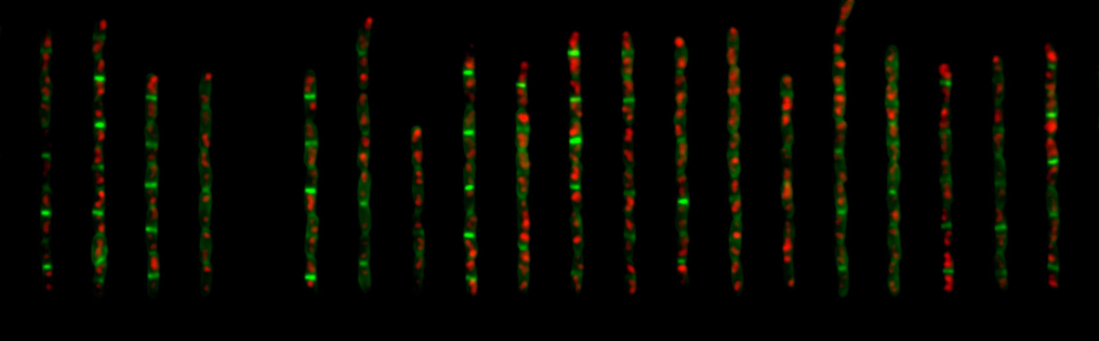 Microscopic image of cells lined up next to each other