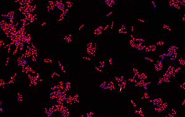 A fluorescence microscopy image reveals the tuberculosis-causing bacterium Mycobacterium tuberculosis after an antimicrobial treatment.