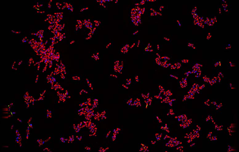 fluorescence microscopy image